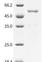 Newcastle disease virus Fusion glycoprotein F0 (F), partial Recombinant Protein, C-His, aa 32–500, strain Chicken/United States/LaSota/46 - BioCrest Sci