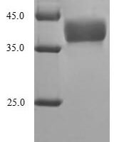 Xenopus laevis Histone H1.0-A (h1f0-a) Recombinant Protein - BioCrest Sci