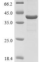 Rat Chitinase-3-like protein 1 (Chi3l1) Recombinant Protein - BioCrest Sci