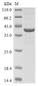Rat Chitinase-3-like protein 1 (Chi3l1) Recombinant Protein, Rattus norvegicus (Rat), E.coli, N-terminal 6xHis-tagged, 44.5 kDa, purity >≥ 85% as determined by SDS-PAGE.