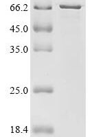 Human Histone deacetylase 2 (HDAC2) Recombinant Protein - BioCrest Sci