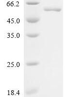 Stenotrophomonas maltophilia Probable cytosol aminopeptidase (pepA) Recombinant Protein - BioCrest Sci