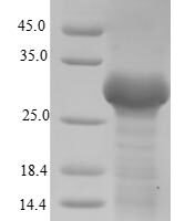 Enterobacter aerogenes Ribitol 2-dehydrogenase (rbtD) Recombinant Protein - BioCrest Sci
