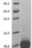 Human Coagulation factor IX (F9), partial Recombinant Protein, C-10His - BioCrest Sci