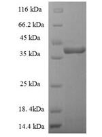 Staphylococcus aureus Enterotoxin type G (entG) Recombinant Protein - BioCrest Sci