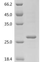 Mouse Cytochrome c1, heme protein, mitochondrial (Cyc1), partial Recombinant Protein, C-Flag - BioCrest Sci