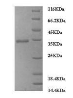 Human IgG receptor FcRn large subunit p51 (FCGRT), partial Recombinant Protein, N-His, aa 24–297, Mammalian cell - BioCrest Sci