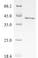 Human Heterogeneous nuclear ribonucleoproteins A2/B1 (HNRNPA2B1) Recombinant Protein, N-His - BioCrest Sci