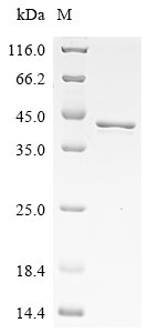 Human Heterogeneous nuclear ribonucleoproteins A2/B1 (HNRNPA2B1) Recombinant Protein, N-His, Homo sapiens (Human), E.coli, N-terminal 6xHis-tagged, 41.5 kDa, purity >≥ 85% as determined by SDS-PAGE.