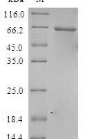 Human Casein kinase I isoform alpha-like (CSNK1A1L) Recombinant Protein - BioCrest Sci