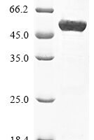 Human Keratin,type II cytoskeletal 8 (KRT8) Recombinant Protein - BioCrest Sci