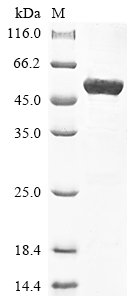 Human Keratin,type II cytoskeletal 8 (KRT8) Recombinant Protein, Homo sapiens (Human), E.coli, N-terminal 6xHis-tagged, 57.8 kDa, purity >≥ 85% as determined by SDS-PAGE.