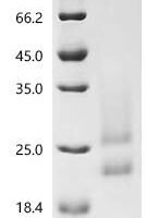 Mouse H-2 class II histocompatibility antigen, A-B alpha chain (H2-Aa), partial Recombinant Protein, C-His, aa 24–218, Yeast - BioCrest Sci