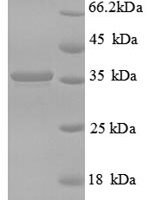 Human CD59 glycoprotein (CD59) Recombinant Protein - BioCrest Sci