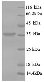 Human CD59 glycoprotein (CD59) Recombinant Protein, Homo sapiens (Human), E.coli, N-terminal GST-tagged, 36.0 kDa, purity >≥ 90% as determined by SDS-PAGE.