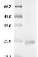 Bovine Interleukin-17A (IL17A) Recombinant Protein, C-His - BioCrest Sci