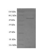 Human Endoplasmic reticulum-Golgi intermediate compartment protein 3 (ERGIC3), partial Recombinant Protein - BioCrest Sci