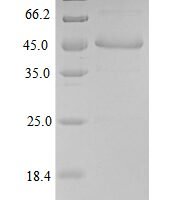 Human Fibroblast growth factor 10 (FGF10) Recombinant Protein - BioCrest Sci