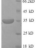 Human DNA-3-methyladenine glycosylase (MPG), partial Recombinant Protein - BioCrest Sci