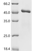 Human papillomavirus type 18 Regulatory protein E2 (E2) Recombinant Protein, C-His - BioCrest Sci