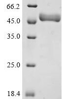 Dengue virus type 2 Genome polyprotein, partial Recombinant Protein - BioCrest Sci