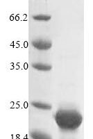 Mouse Cystatin-C (Cst3) Recombinant Protein - BioCrest Sci