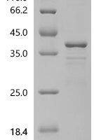 Human Golgi-associated plant pathogenesis-related protein 1 (GLIPR2), partial Recombinant Protein - BioCrest Sci