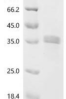 Mouse Nephrin (Nphs1), partial Recombinant Protein, C-His, aa 36–250, Yeast - BioCrest Sci