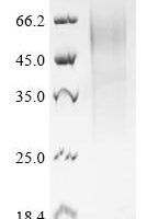 Mouse Histidine-rich glycoprotein (Hrg) Recombinant Protein - BioCrest Sci