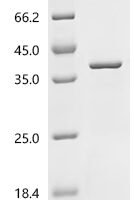 Human 11-beta-hydroxysteroid dehydrogenase 1 (HSD11B1), partial Recombinant Protein, C-10His - BioCrest Sci