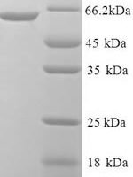 Human Innate immunity activator protein (INAVA) Recombinant Protein - BioCrest Sci