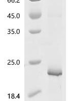 Mouse Prokineticin-2 (Prok2) Recombinant Protein, C-His - BioCrest Sci