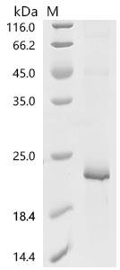 Mouse Prokineticin-2 (Prok2) Recombinant Protein, C-His, E.coli, C-terminal 6xHis-tagged, 18.4 kDa, purity >≥ 90% as determined by SDS-PAGE.