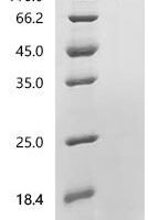 Human Coagulation factor X (F10), partial Recombinant Protein, C-10His, aa 86–122 - BioCrest Sci