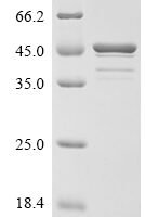 Anisakis simplex Tropomyosin Recombinant Protein, C-His - BioCrest Sci