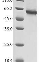 Human TNF receptor-associated factor 6 (TRAF6) Recombinant Protein, Tag-Free - BioCrest Sci