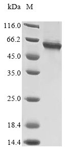 Human TNF receptor-associated factor 6 (TRAF6) Recombinant Protein, Tag-Free, Homo sapiens (Human), E.coli, Tag-Free, 59.6 kDa, purity >≥ 85% as determined by SDS-PAGE.