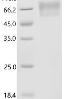 Human RecQ-like DNA helicase BLM (BLM) (K24A), partial Recombinant Protein, C-10His - BioCrest Sci
