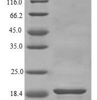 Human Fibroblast growth factor 1 (FGF1) Recombinant Protein, C-His - BioCrest Sci