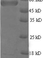 Mouse Microtubule-associated protein 2 (Map2), partial Recombinant Protein, N-His-SUMO - BioCrest Sci