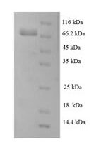 Human Leucine-rich repeat-containing protein 40 (LRRC40) Recombinant Protein - BioCrest Sci