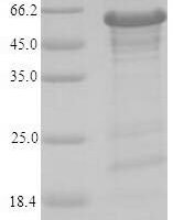 Human Zinc finger protein 638 (ZNF638), partial Recombinant Protein - BioCrest Sci