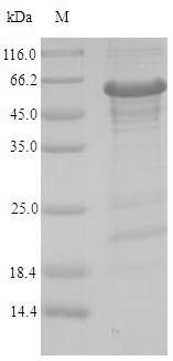 Human Zinc finger protein 638 (ZNF638), partial Recombinant Protein, Homo sapiens (Human), E.coli, N-terminal 6xHis-SUMO-tagged, 47.2 kDa, purity >≥ 90% as determined by SDS-PAGE.