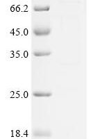 Human FYVE, RhoGEF and PH domain-containing protein 3 (FGD3) Recombinant Protein - BioCrest Sci