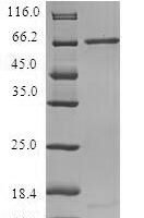 Human Protein XRP2 (RP2) Recombinant Protein - BioCrest Sci