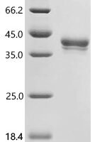 Mouse Annexin A1 (Anxa1) Recombinant Protein, C-10His - BioCrest Sci