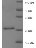 Human Dynein light chain roadblock-type 1 (DYNLRB1), partial Recombinant Protein - BioCrest Sci