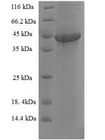 Human Sesquipedalian-2 (FAM109B) Recombinant Protein - BioCrest Sci