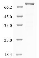 Human RING finger protein 207 (RNF207) Recombinant Protein - BioCrest Sci