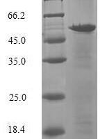 Human Histone chaperone ASF1A (ASF1A) Recombinant Protein - BioCrest Sci